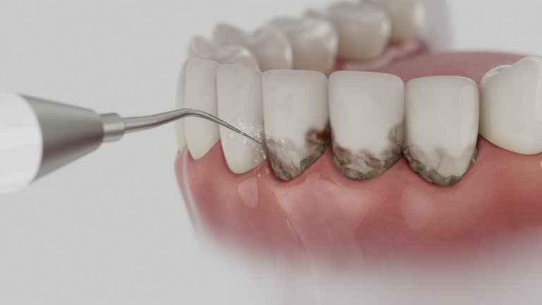 Reliable Root Canal Treatment contractor in Geauga County County, OH by Dentist Open Now